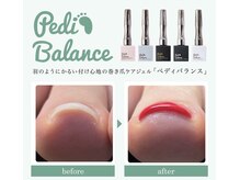 テテネイル(tete.nail)/フット　カラー付き巻き爪ケア