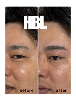 エースビューティーサロン 蒲郡店(ACE. beauty salon)/眉癖改善HBL ビフォーアフター