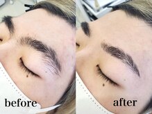 ベルバイグレイス(BELLE by grace)