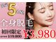 アルゴ 越前店(ALGO)の写真