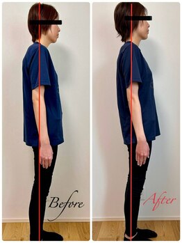 シームル/猫背矯正/姿勢改善（30代女性）