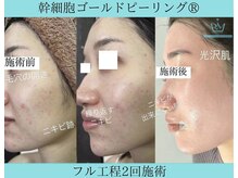 リメイク 広尾(REMAKE)/