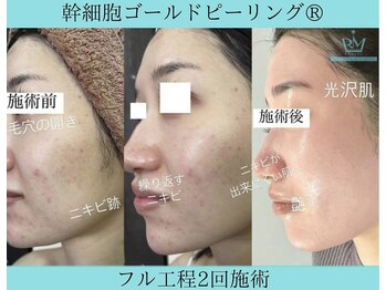 リメイク 広尾(REMAKE)/