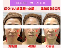 ユーフォリア(Euphoria)