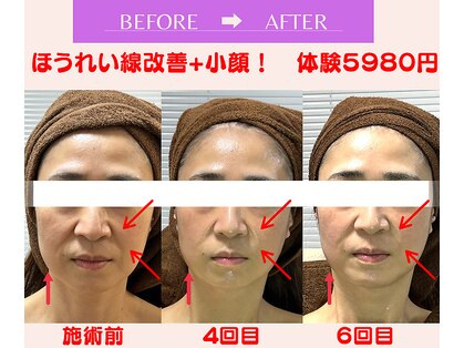 ユーフォリア(Euphoria)の写真