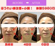 ユーフォリア(Euphoria)