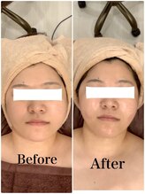 スペチアーレ 夙川/驚きのリフトアップ