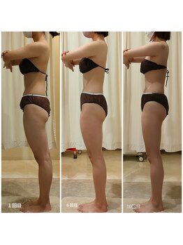 ルノン(Lunon)/《歪み改善》前もも張りケア