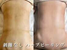 ダリア(Dahlia)/色味のケアにも