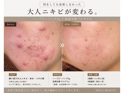 ホクビューティー(HOCU BEAUTY)の写真