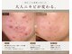 ホクビューティー(HOCU BEAUTY)の写真