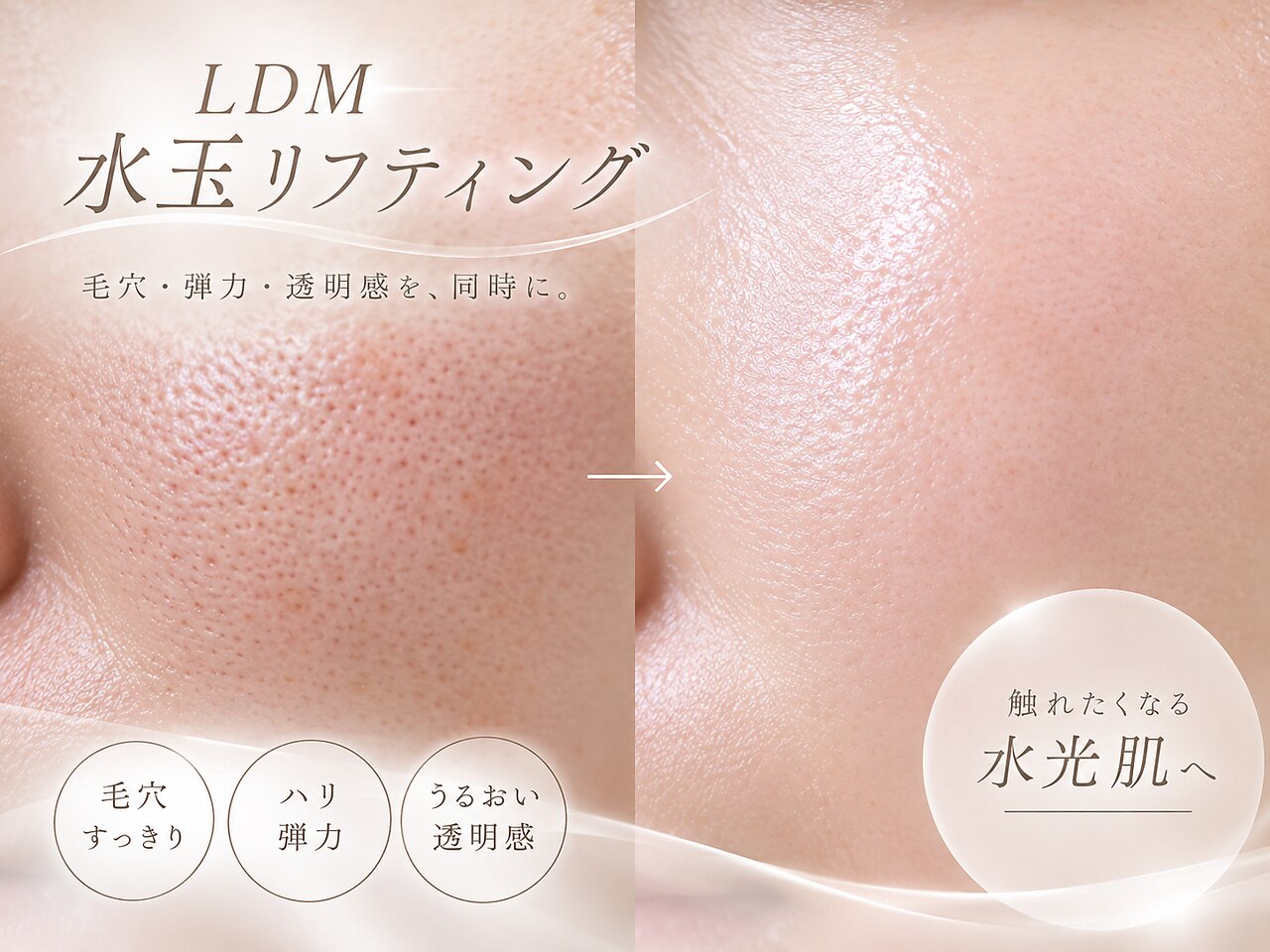 5ページ目｜水玉リフティング 東京に関するエステサロン La・mer【毛穴