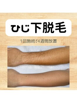 ビクト(Vict)/清潔感UPします!