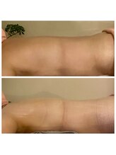 クィーンダム(Queendom)/むくみスッキリ