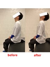 ナオル整体 福岡香椎院(NAORU整体)/40代男性施術事例【首こり】