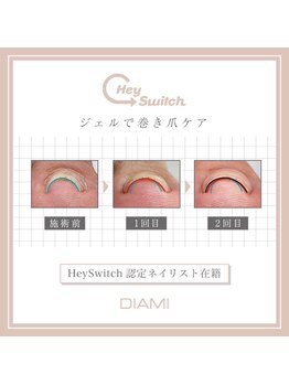 ネイルサロン レボルデ/巻き爪ケア