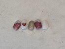 PG010655581