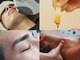 アンジェリーナの写真/■メンズ脱毛【眉毛,鼻毛,ヒゲ～ＶＩＯ含む全身】男性のムダ毛のお悩み解消サロン■ヘッドスパ30分¥4,900～