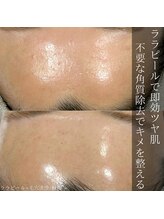 アウラプラス(Aura+)/ざらつき・ごわつき改善◎