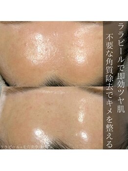 アウラプラス(Aura+)/ざらつき・ごわつき改善◎