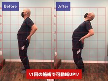 かいせい整体院/施術のビフォー/アフター