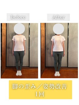 ロータス(LOTUS)/太ももの左右差・腿の張り出し