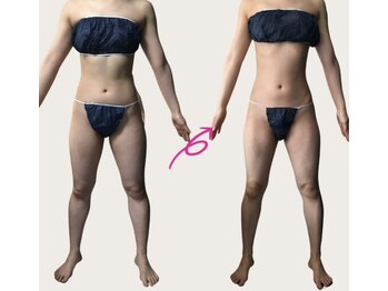 ネオボディ(Neo Body)/洋服のサイズにも変化が◎