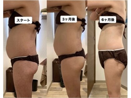 ボディメンテナンス 北方の写真