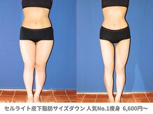 ピュアノア 三木店/痩身　三木/小野/西脇/加東/加西