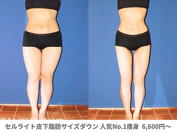 ピュアノア 三木店/痩身　三木/小野/西脇/加東/加西