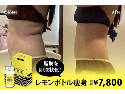 アネル 豊見城(anel)の写真