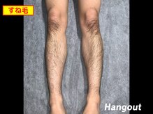 ハングアウト(HANGOUT)/【久留米メンズ脱毛】脚毛前