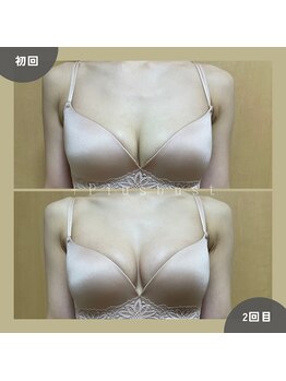 プラス バスト(+Plusバスト)/お客様BeforeAfterお写真