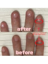レア(Lea)/クリアネイル　before→after