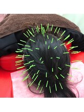 よつば鍼灸整骨院 春日院/頭皮鍼