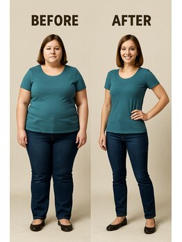 ラピス(Lapis)/ビフォーアフター！