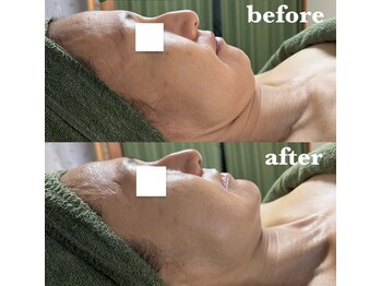 リーフィア(Leafia)/たるみケア◎