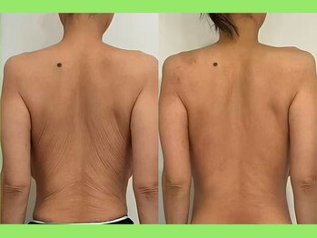 健康美 東洋医学療法院 鴻巣店/魔法のかっさ×美らくる吸引