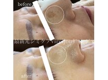 プライベートアイラッシュサロン ヴィレージュ 稲毛店(Vireijou)の雰囲気（シミケアコース／レモンボトルのメニュー）