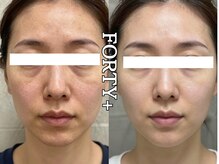 フォーティープラス(FORTY+)/施術事例