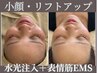 OPEN限定★残り10名　リフトアップ体験【水光注入+EMS】¥2200