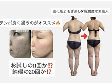 ヨサパーク マオ(YOSA PARK Mao)