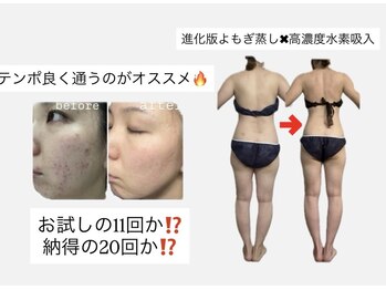 ヨサパーク マオ(YOSA PARK Mao)の写真/女性の美を引き出す究極の温活ダイエット!基礎代謝UP&脂肪燃焼で理想の体型へと導きます!