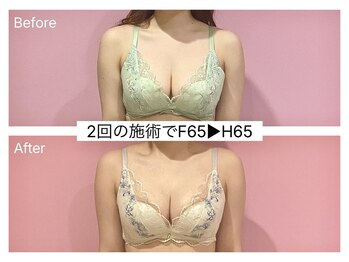 ククナ(KUKUNA)/*バストアップマッサージ*