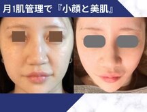 ミエリア美容鍼灸院(mielia美容鍼灸院)
