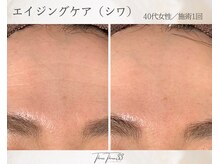 スリースリー 恵比寿(THREE THREE)/エイジングケア・しわ・たるみ