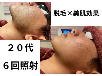 カイ メンズ脱毛アンドネイル(KAI)の写真/【初めての脱毛に】12年間続くメンズ脱毛専門サロン。実績のあるサロンで確実な効果を求めたい人におすすめ
