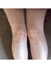 LTサロン グレース(Grace)/脚のリンパトリートメント！