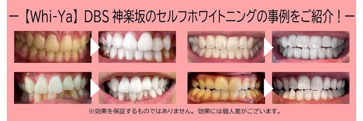 ホワイヤ セルフホワイトニング DBS神楽坂(Whi-Ya)のサロンヘッダー