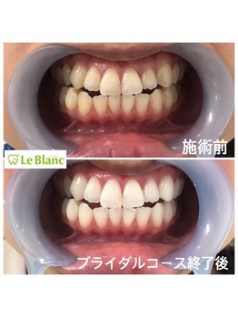 ルブラン 奈良店(Le Blanc)/ブライダルコース終了!!